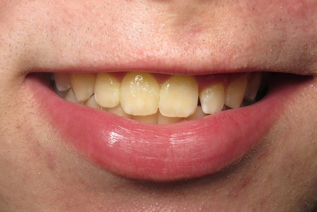 Cosmetic Dentistry Williamsburg VA