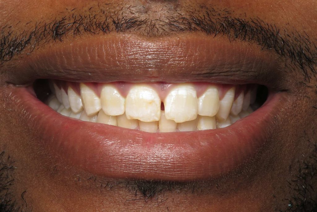 Cosmetic Dentistry Williamsburg VA
